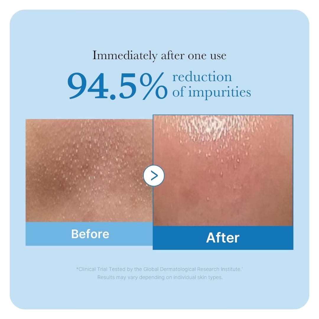 Medicube Zero Pore Blackhead Deep Cleansing Oil 205ml