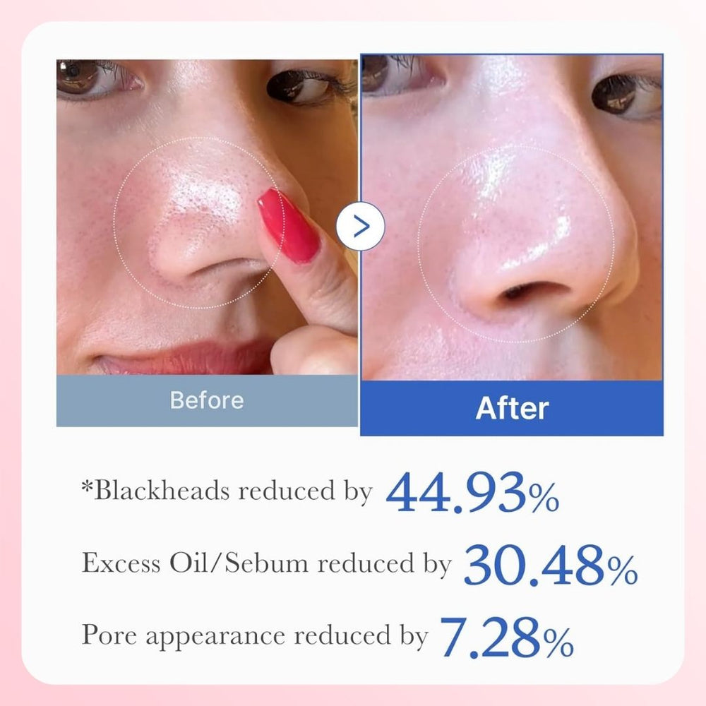 Medicube Zero Pore Pad 2.0 (70 PAD)