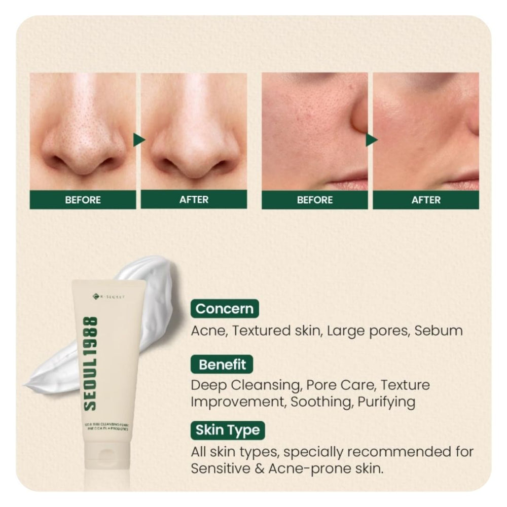 K-Secret Seoul 1988 Cleansing Foam (Pine Cica 1% + Probiotics) 150ml