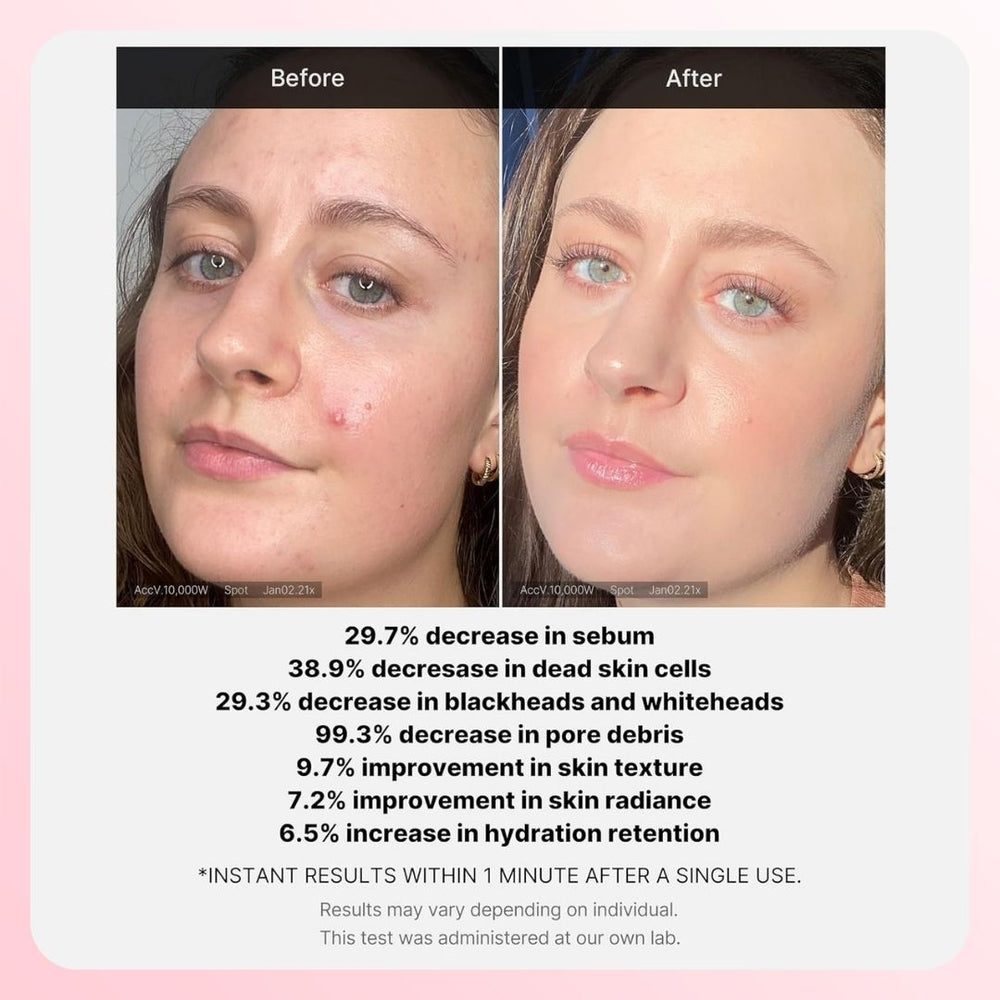 Medicube Red Acne Succins Acid Peel 40 G
