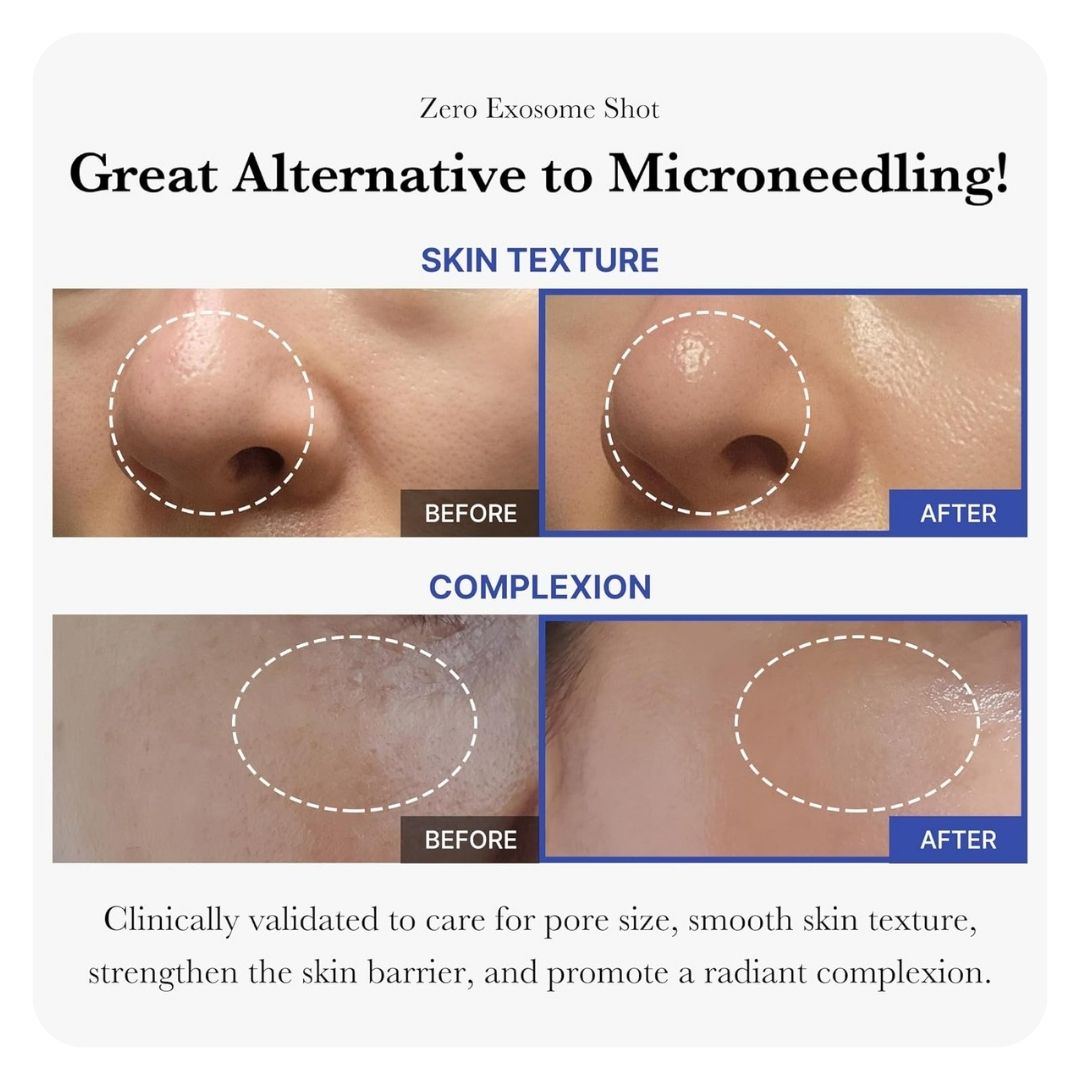 Medicube Zero Exosome Shot 30ml