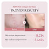 Medicube PDRN Pink Collagen Gel Mask