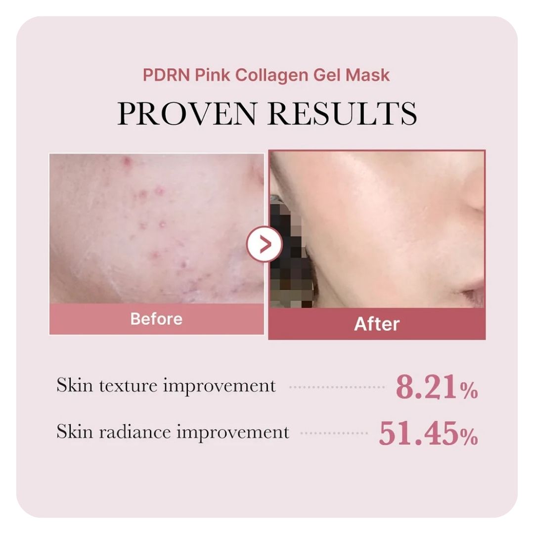 Medicube PDRN Pink Collagen Gel Mask