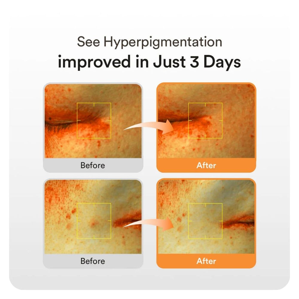 Abib Glutathiosome Dark Spot Serum Vita Drop 50 ml