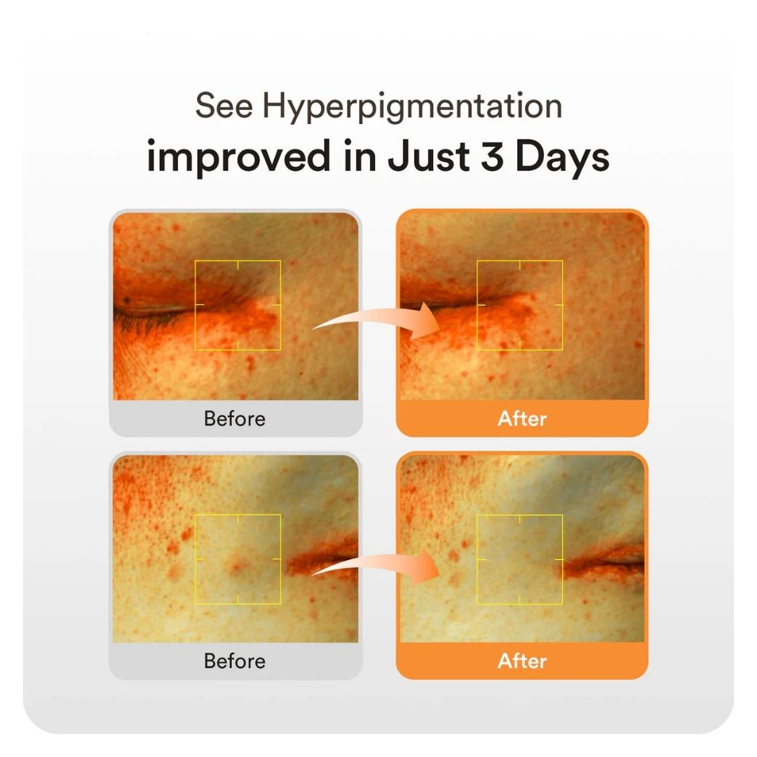 Abib Glutathiosome Dark Spot Serum Vita Drop 50 ml