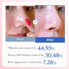 Medicube Zero Pore Pad 2.0 (70 PAD)