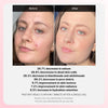 Medicube Red Acne Succins Acid Peel 40 G