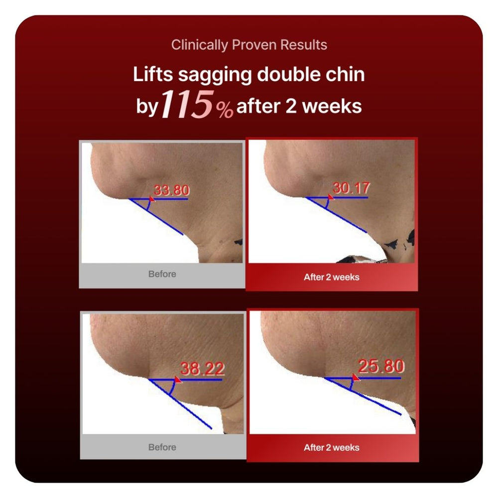 Meditherapy Collagen Wrinkle-fit Neck Mask