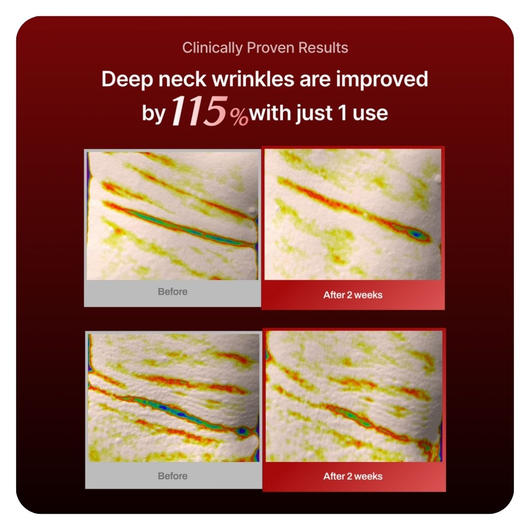 Meditherapy Collagen Wrinkle-fit Neck Mask