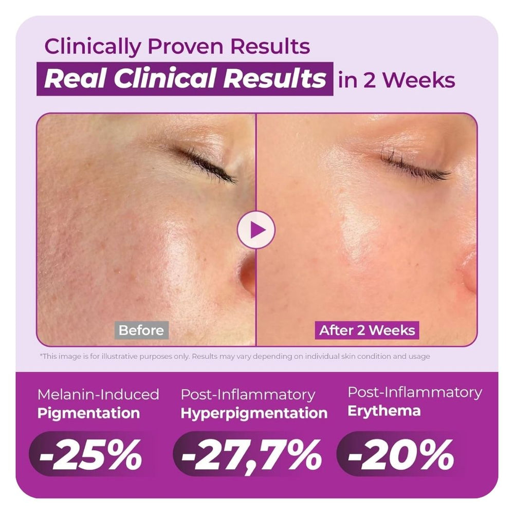 Jumiso Niacinamide 20% Serum