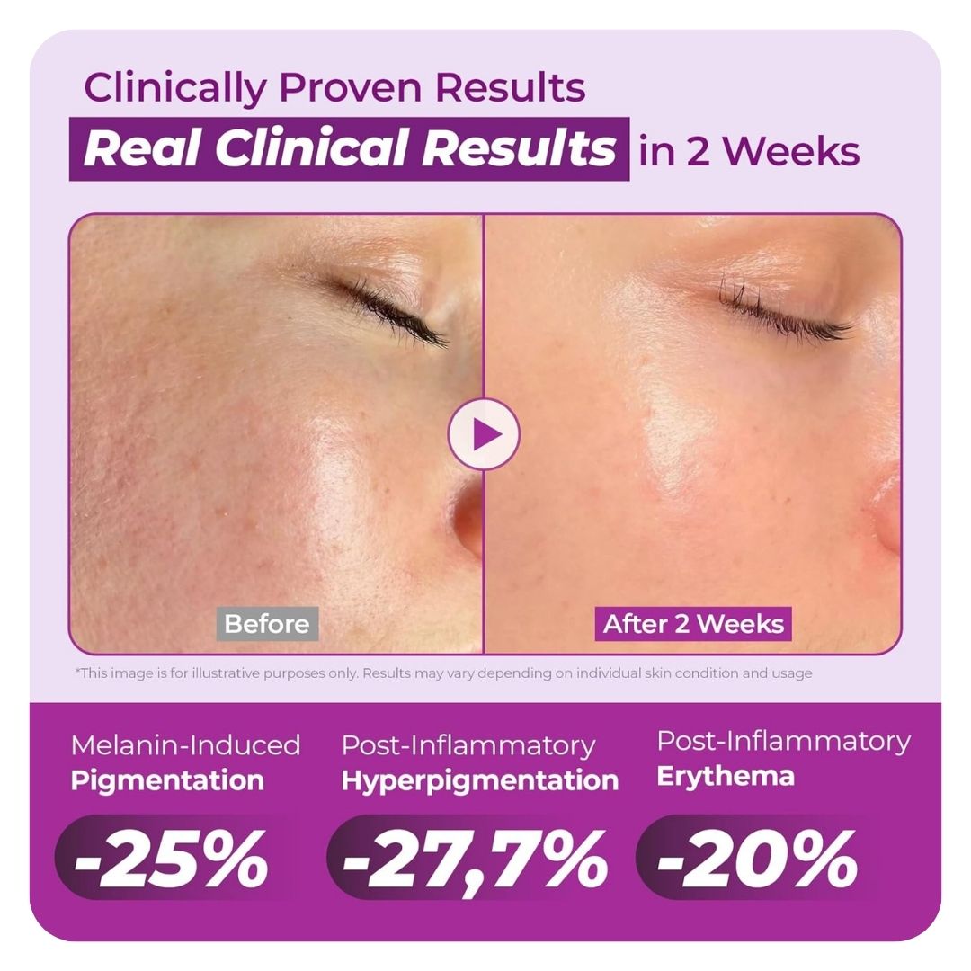 Jumiso Niacinamide 20% Serum