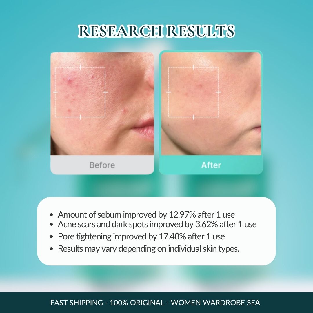 Medicube Azelaic Acid 16 BB Calming Serum (30ml)