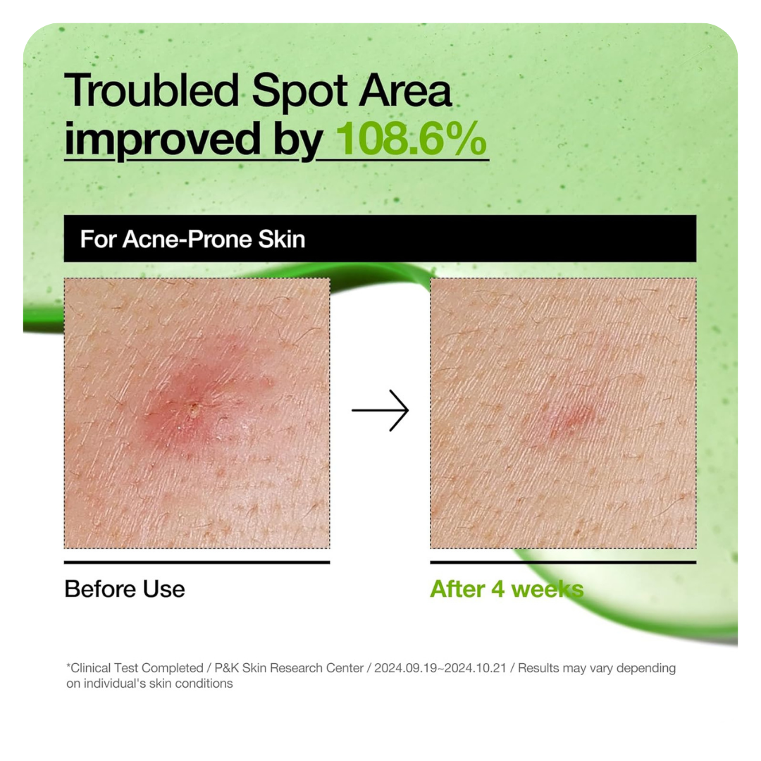 Anua Azelaic Acid 10 Hyaluron Redness Soothing Serum 30ml