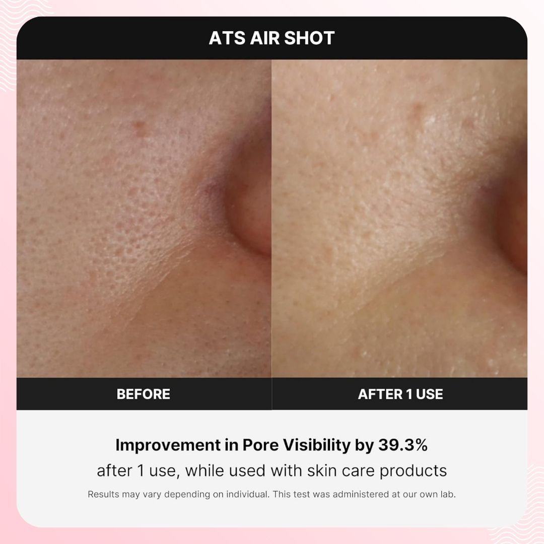 Medicube AGE-R ATS Air Shot Device