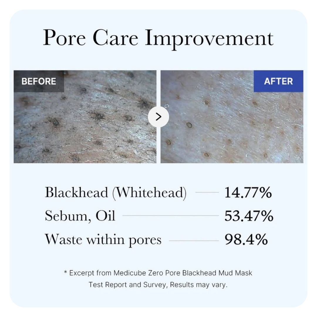 Medicube Zero Pore Blackhead Mud Mask 100g