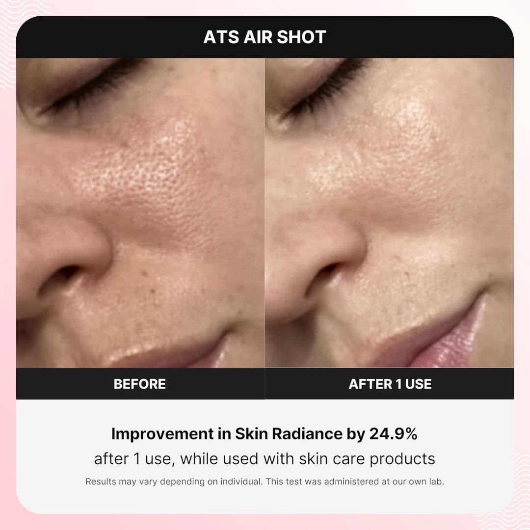 Medicube AGE-R ATS Air Shot Device