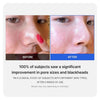 Medicube Zero Pore Cream 2.0 50ml